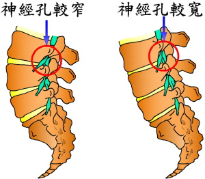 脊椎前屈後屈姿勢4