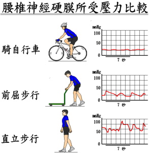 腰椎神經硬膜所受壓力比較1